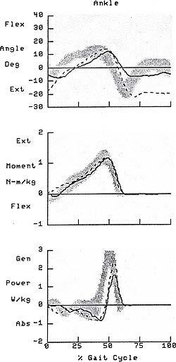 3 Case-Study-Lin-Evaluation-of-the-Pressure-Relief-AFO-opt