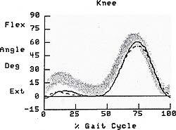 4 Case-Study-Lin-Evaluation-of-the-Pressure-Relief-AFO-opt