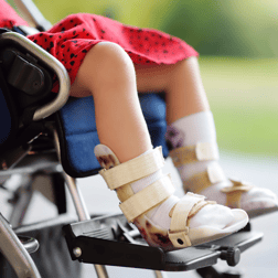 Cerebral Palsy (1)