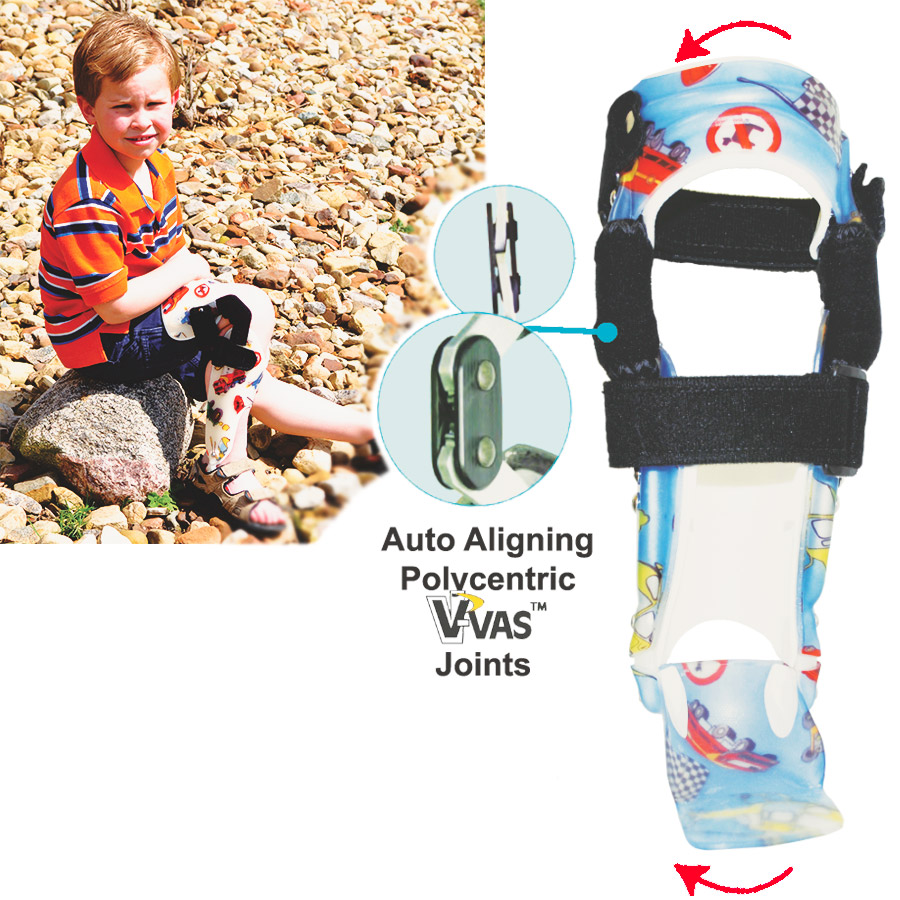 Pediatric Orthotics Custom Knee Ankle Foot Orthosis (KAFO Brace)